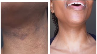 Kuhle Jita S04E02 | I Got Rid of My Eczema